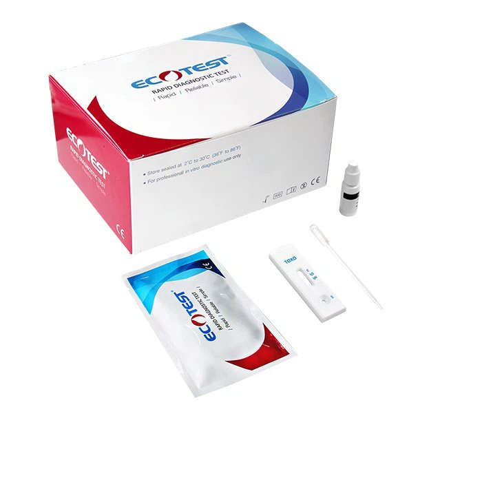 Prueba de toxoplasmosis IgG e IgM